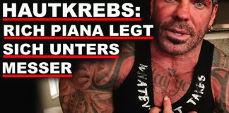 Hautkrebs: Rich Piana muss erneut unters Messer!